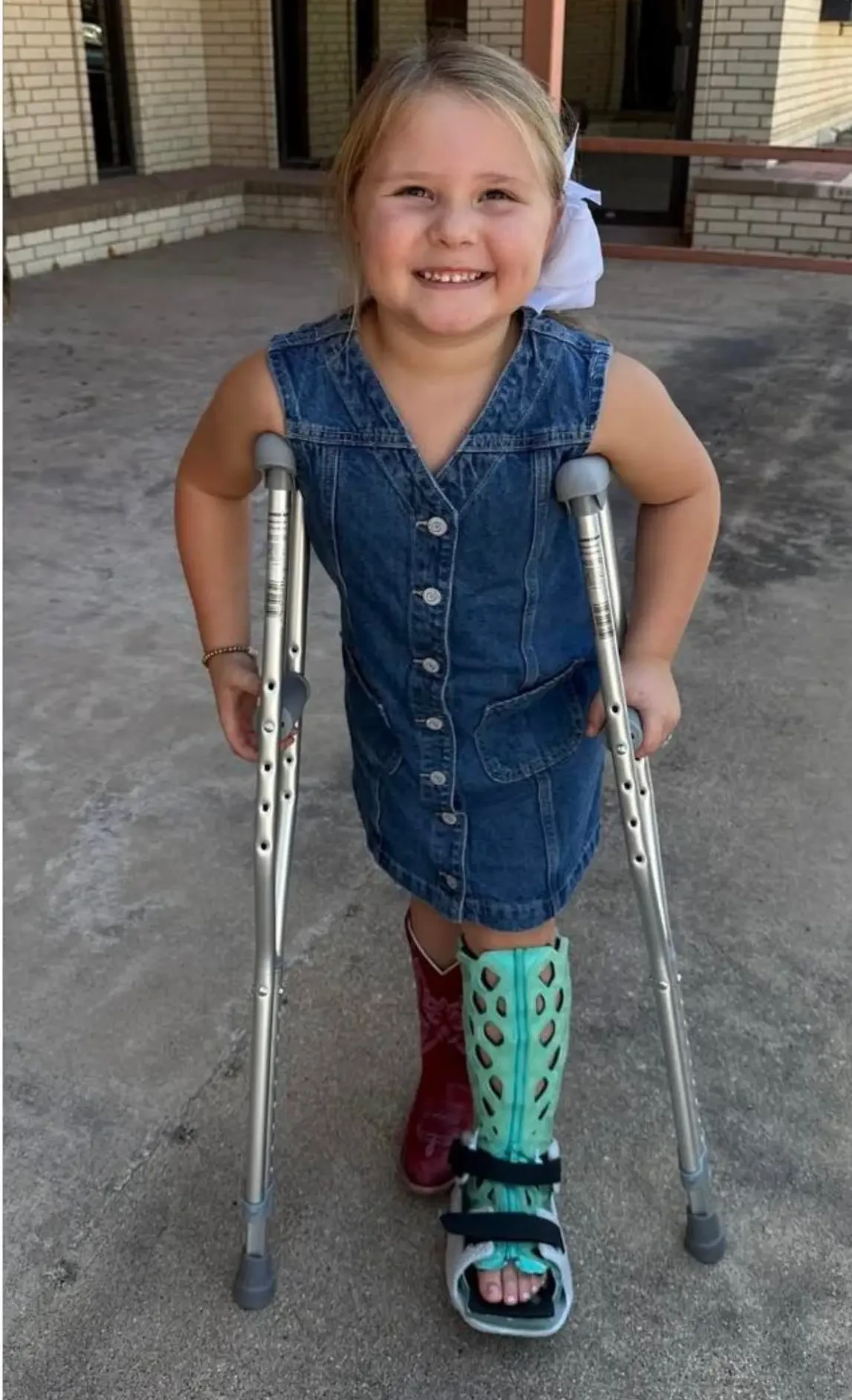 Young girl wearing a FlexiOH pediatric waterproof cast on her leg, smiling with crutches