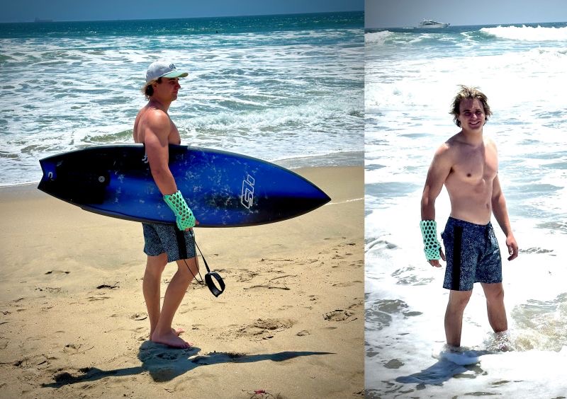 Person at the beach with a FlexiOH waterproof cast on their wrist, demonstrating full waterproof capability